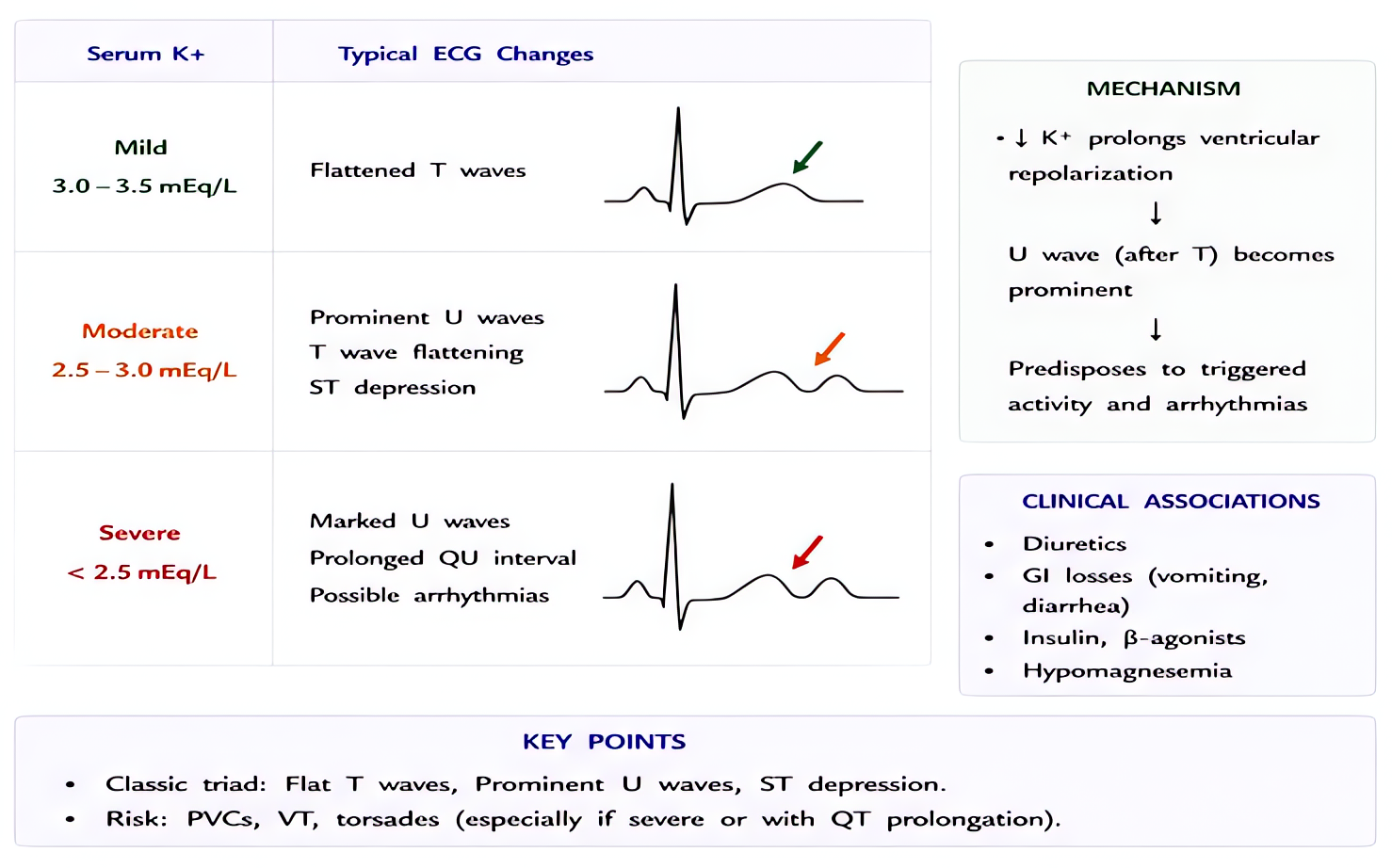 Hypokalemia ECG changes: flattened T waves, prominent U waves, ST depression, prolonged QT; predisposes to torsades, digoxin toxicity, ventricular arrhythmias; treat with KCl repletion, address Mg2+ d