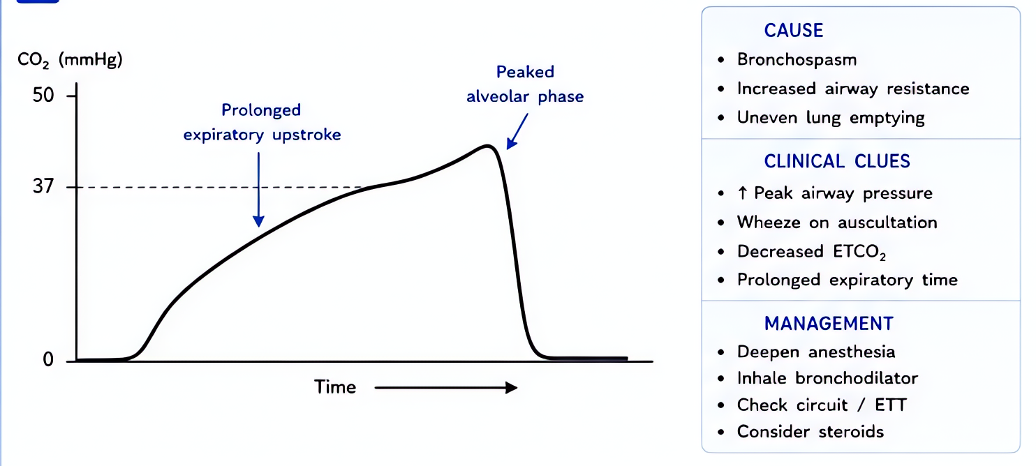 Bronchospasm capnograph shows 'shark fin' pattern: upsloping phase III due to prolonged expiratory phase from variable airway obstruction; treat with bronchodilators and deepening anesthesia.