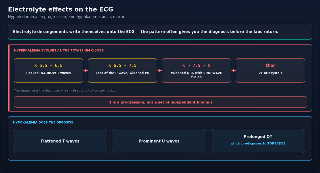 How electrolyte derangements and common drugs mark the ECG. Read the potassium findings as one evolving progression rather than separate signs — a single strip out of context can mislead.