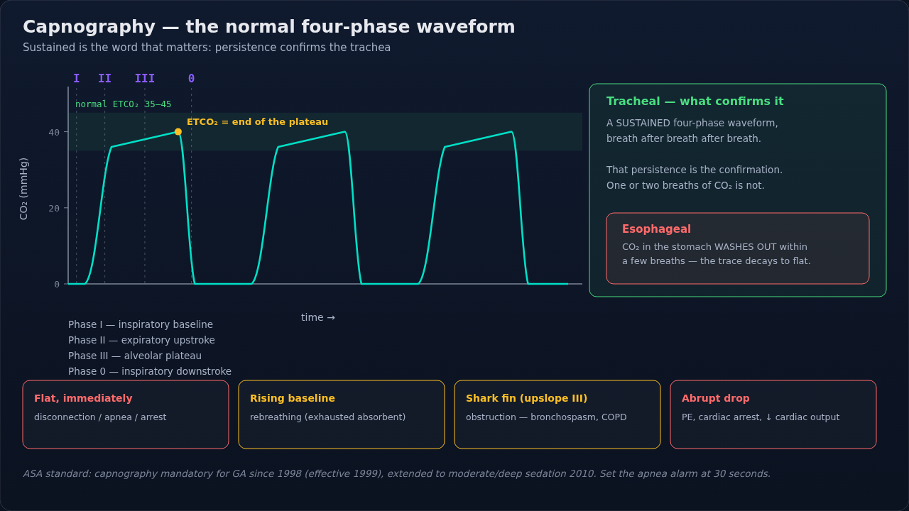 A normal capnogram with its phases labeled, alongside the abnormal patterns worth recognizing at a glance. Learn the normal shape first — every abnormal trace here is a deformation of it.