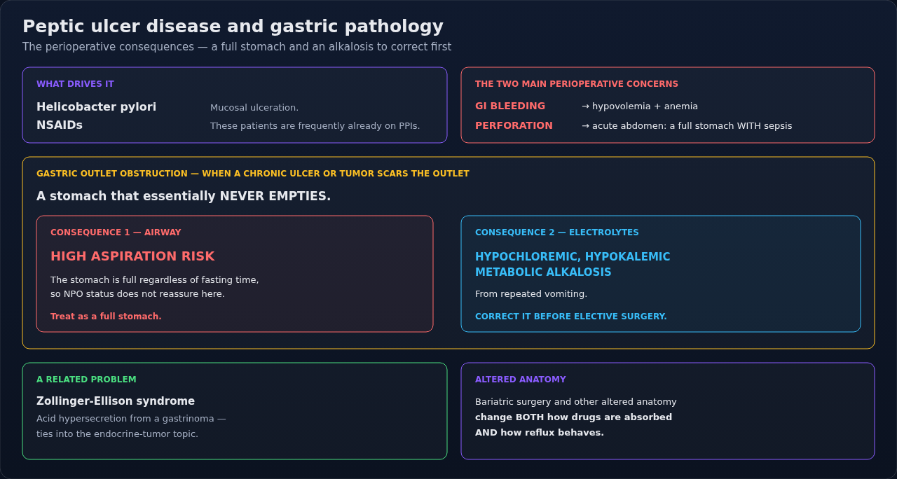 Peptic ulcer disease and related gastric pathology, each mapped to what it changes about the anesthetic. The thread running through is aspiration risk plus the volume and electrolyte deficits that tra