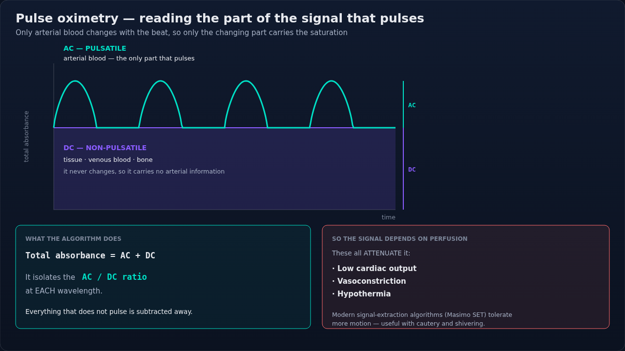 How the oximeter pulls an arterial signal out of total absorbance — a pulsatile component riding on a fixed baseline of tissue, venous blood, and bone. Anything that flattens the pulse flattens the si