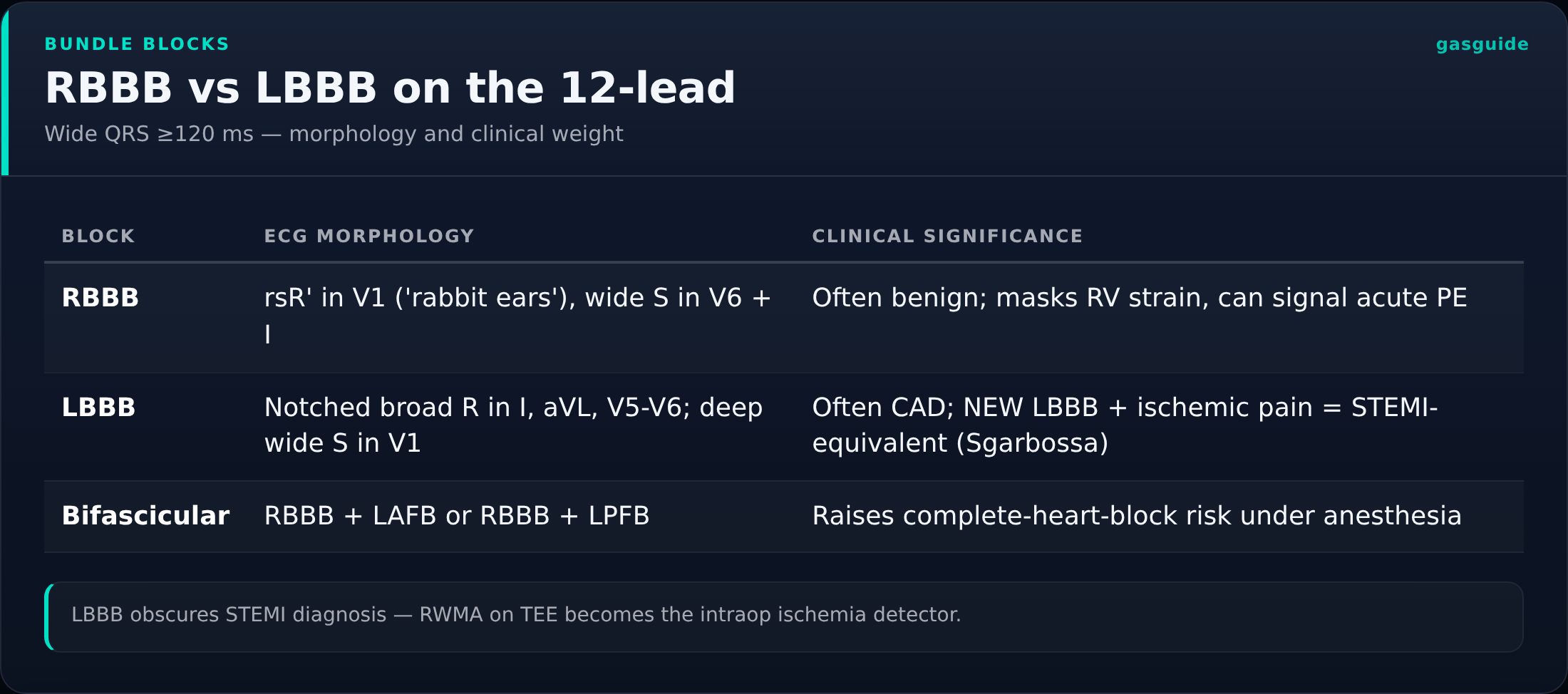 RBBB vs LBBB on the 12-lead — Wide QRS ≥120 ms — morphology and clinical weight