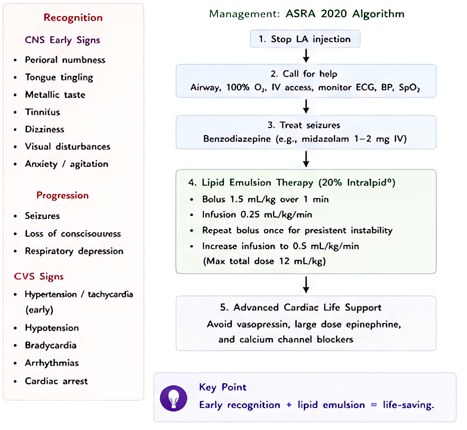 Local anesthetic systemic toxicity (LAST): recognition (perioral numbness, tinnitus, seizures, cardiac arrest) and management with 20% lipid emulsion 1.5 mL/kg bolus then 0.25 mL/kg/min infusion; avoi