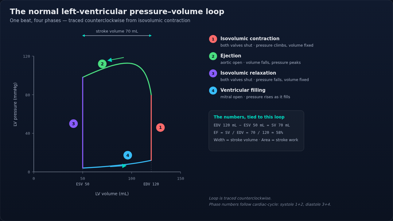 Normal LV pressure-volume loop: four phases labeled, diastolic filling limb rising as the ventricle fills, EDV 120 / ESV 50 / SV 70 mL / EF 58%.