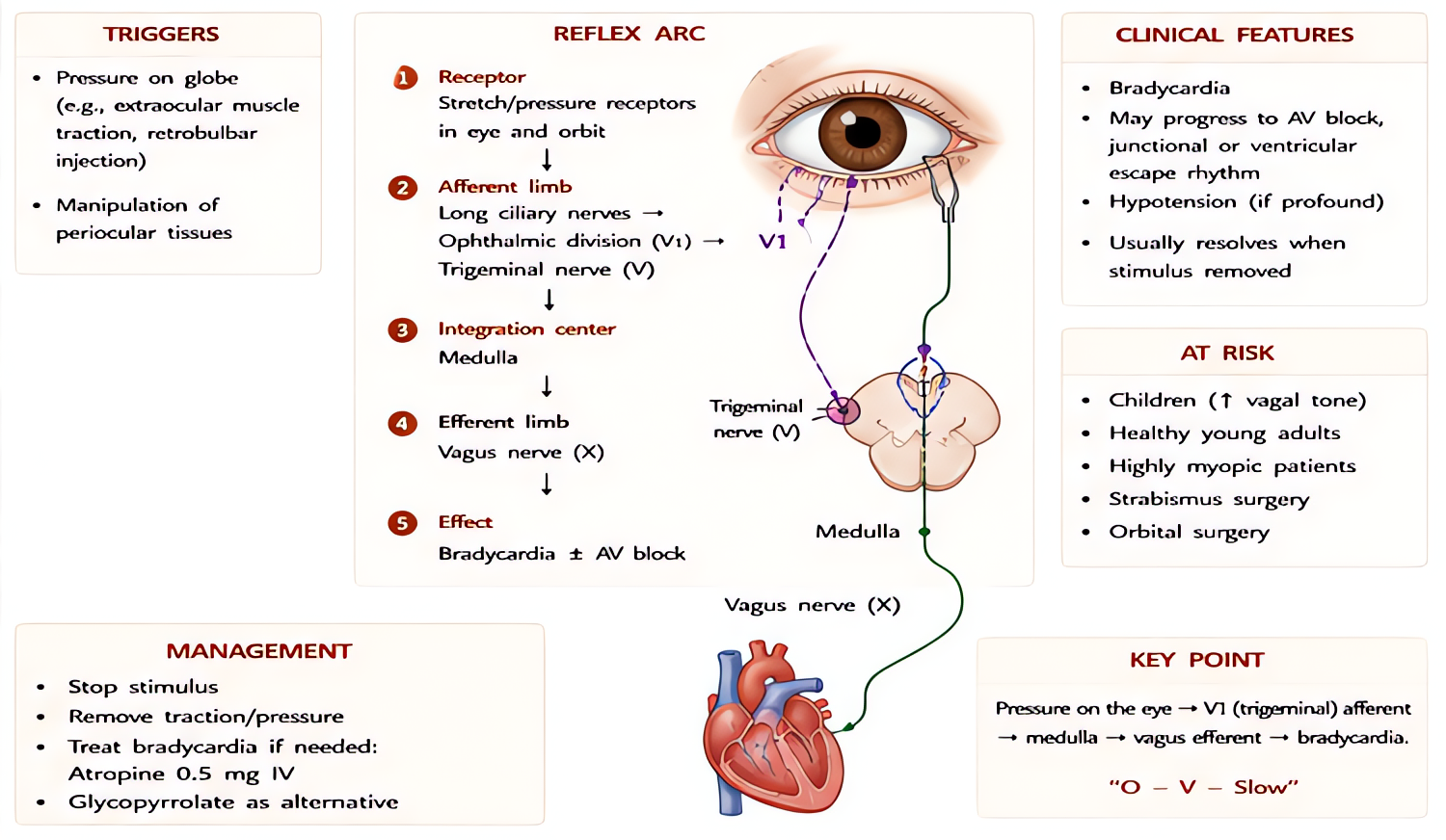 Oculocardiac reflex (Aschner phenomenon): traction on extraocular muscles (esp. medial rectus) -> trigeminal-vagal arc -> bradycardia, AV block, asystole; common in pediatric strabismus surgery; treat