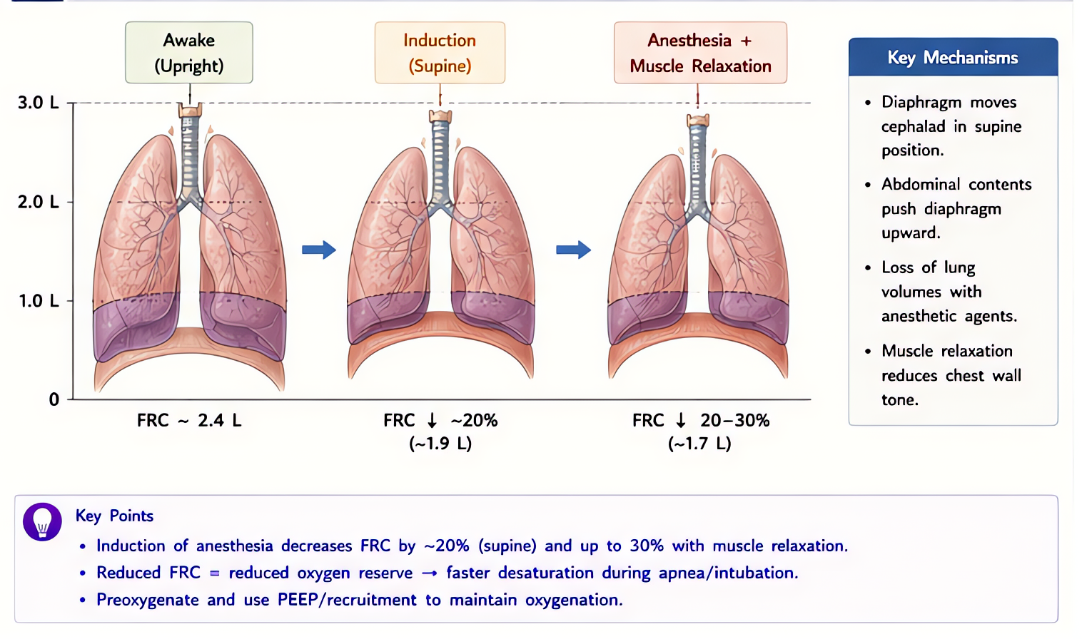 Effect of anesthesia induction on FRC: ~20% decrease awake-to-supine, additional 16-20% reduction with induction/muscle relaxation due to diaphragm cephalad shift, atelectasis, and reduced chest wall