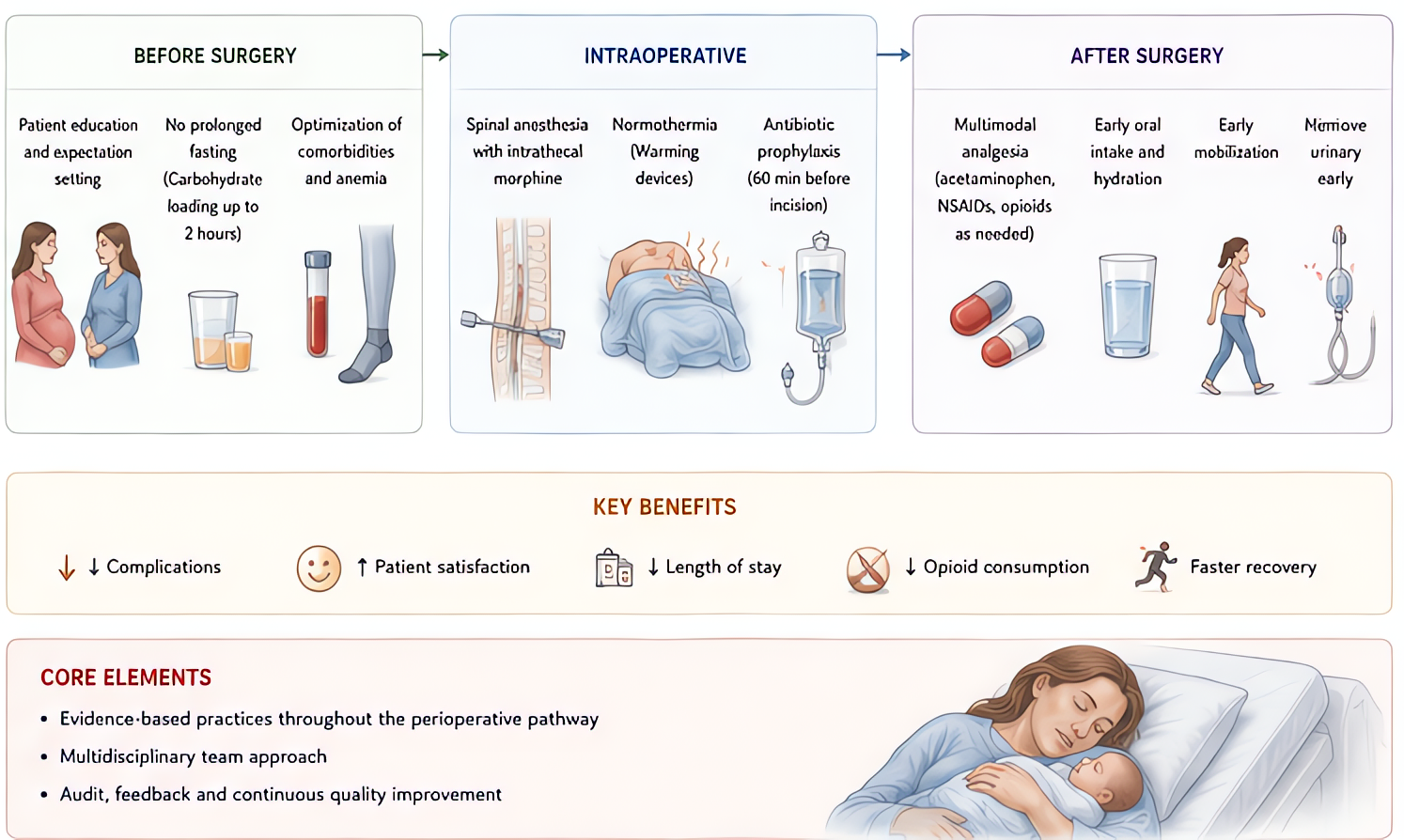 Enhanced Recovery After Surgery (ERAS) for C-section bundles preop carbohydrate loading, multimodal opioid-sparing analgesia, early feeding/ambulation, and standardized antiemetic prophylaxis to reduc