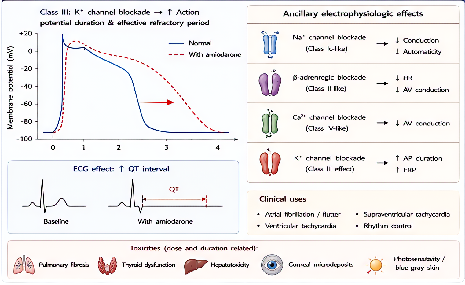 Amiodarone class III (and ancillary I/II/IV) antiarrhythmic: prolongs action-potential duration and QT; ECG effect of QT prolongation. Toxicities: pulmonary, thyroid, hepatic, corneal microdeposits, p