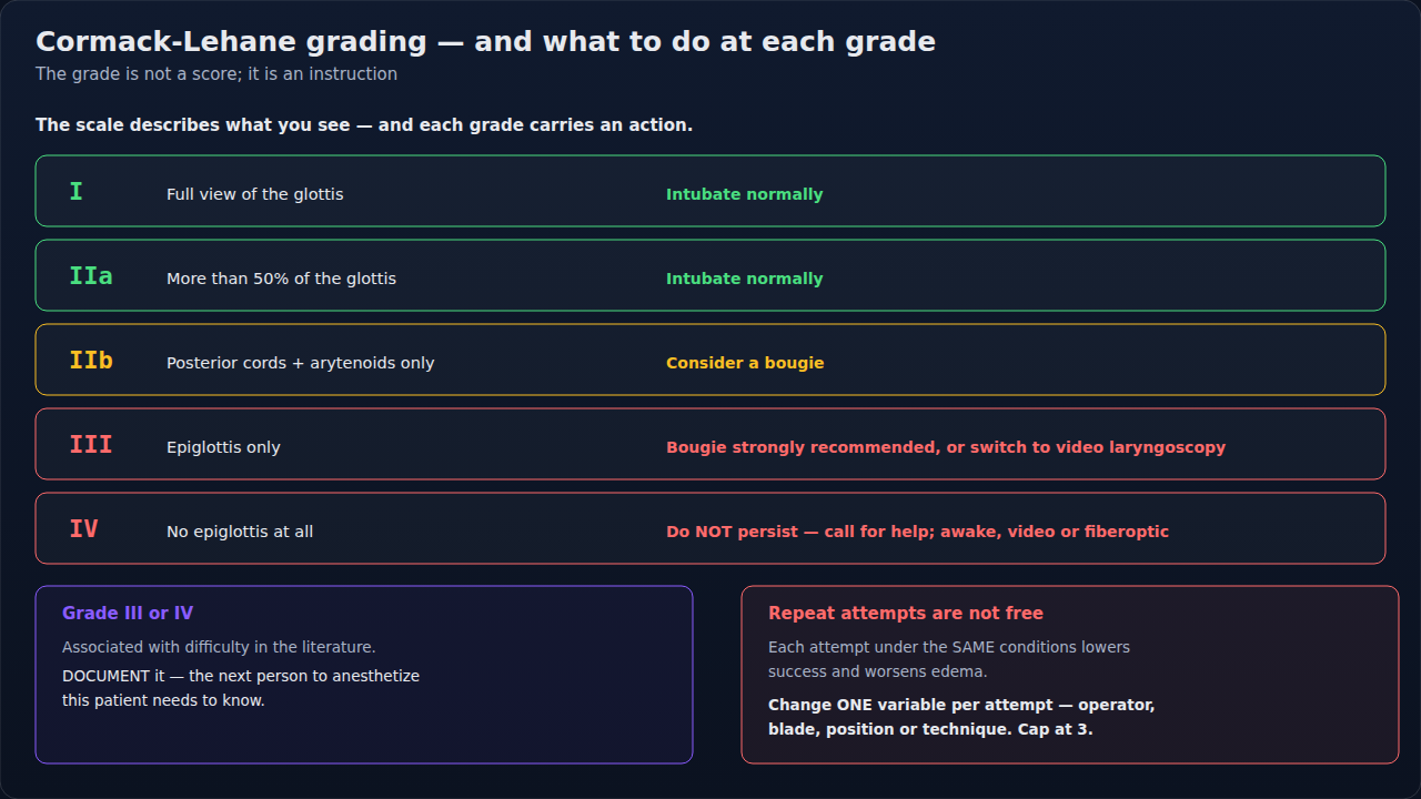 The Cormack-Lehane grades paired with the action each one calls for. Read a grade as an instruction rather than a score — the useful question is what you do next, not what number goes in the chart.